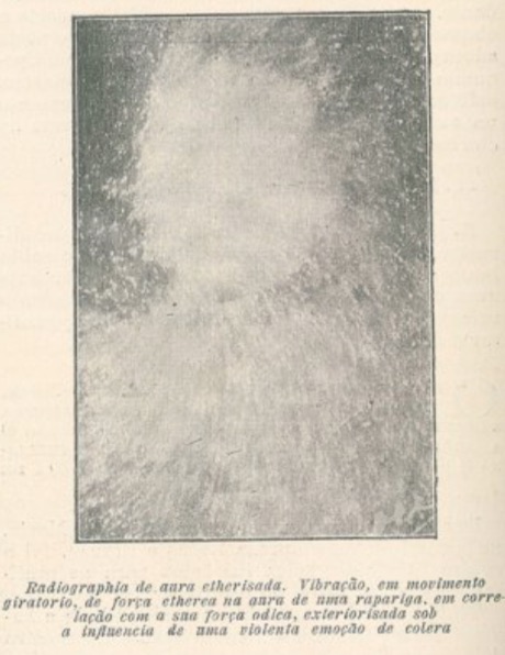 Radiografia da aura Radiografia da mão