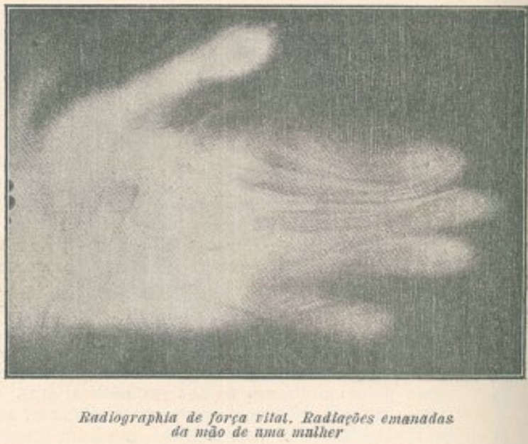 Radiografia da força vital Radiografia da mão