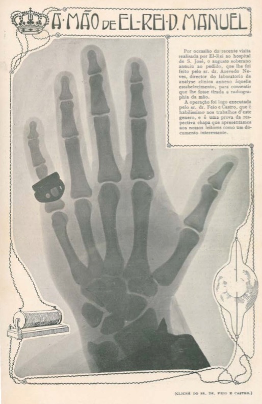 Radiografia da mão do Rei