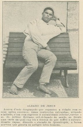 Albano de Jesus, caso de licantropia